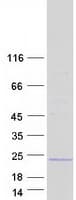 Human C1orf194 Protein (Recombinant Myc-DDK (Flag))