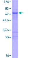 Human PHOX2A Protein (Recombinant GST)