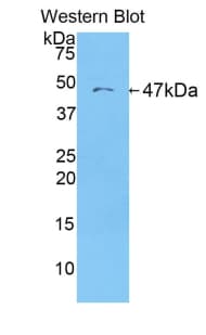 ORM1 / Orosomucoid Antibody (aa19-186)