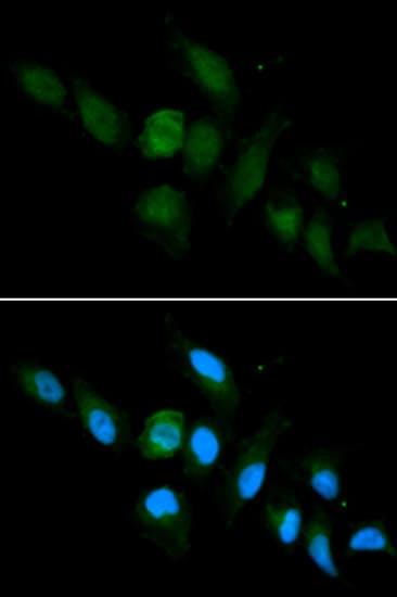 IHC-plus™ Polyclonal Rabbit anti-Human HLA-A Antibody (IHC, IF, WB)