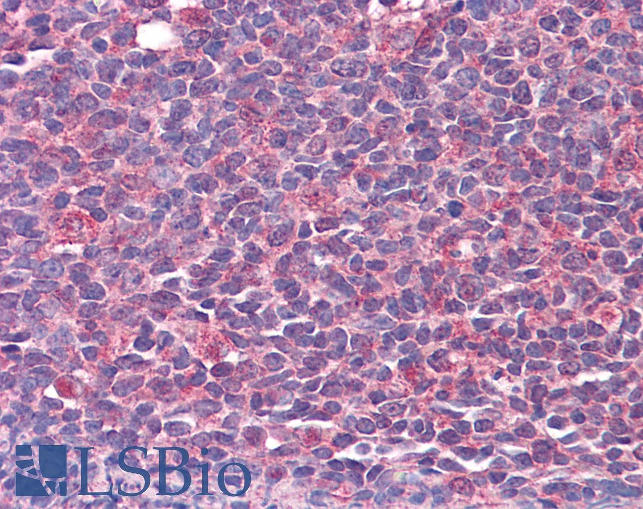 IHC-plus™ Monoclonal Mouse anti-Human CAMK2B / CaMKII Beta Antibody (clone S11, IHC, WB)
