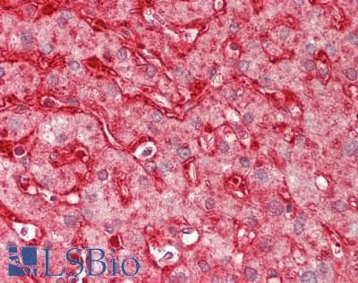 IHC-plus™ Polyclonal Rabbit anti-Human AOX1 / Aldehyde Oxidase Antibody (aa521-570, IHC, WB)