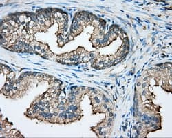 CAPZA1 / CAPZ Alpha 1 Antibody (clone OTI2G4)