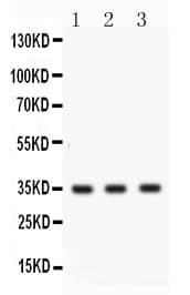 Polyclonal Rabbit anti-Human CTSG / Cathepsin G Antibody (IHC, WB)
