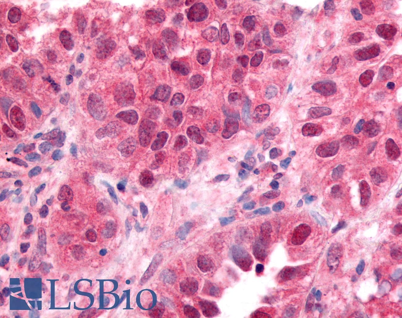 IHC-plus™ ZIF268 / EGR1 Antibody