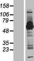 SMAP1 Protein (Over-Expression Lysate Myc-DDK (Flag))