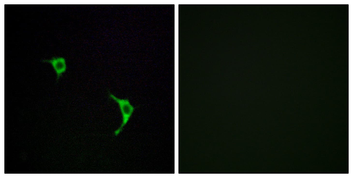 IHC-plus™ JNK1+2+3 Antibody (aa166-215)