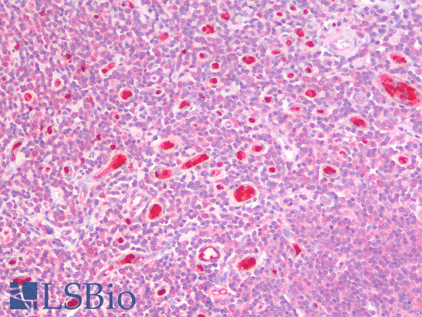 IHC-plus™ Polyclonal Goat anti-Human GSTM4-4 / GSTM4 Antibody (Internal Region, IHC, WB)