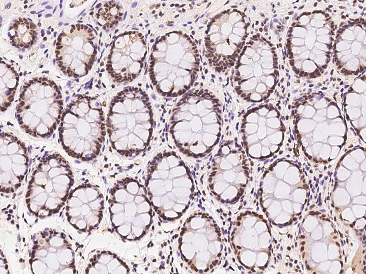 WDR33 Antibody