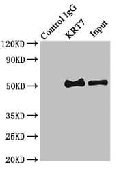 KRT7 / CK7 / Cytokeratin 7 Antibody
