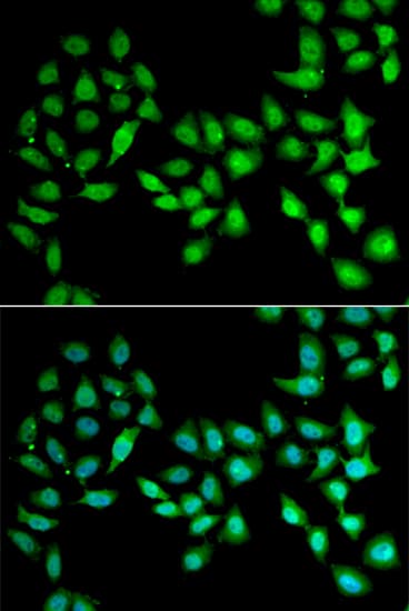 UCN2 / SRP Antibody