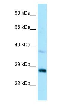 CTDSP1 / SCP1 Antibody (aa72-121)