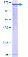 Human NEDD4L / NEDD4-2 Protein (Recombinant GST)
