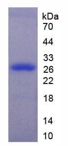 Human MAPK3 / ERK1 Protein (Recombinant His-T7)