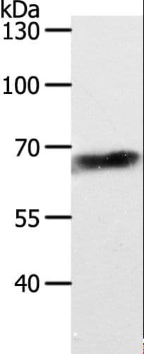 Polyclonal Rabbit anti-Human ABCD4 Antibody (WB)