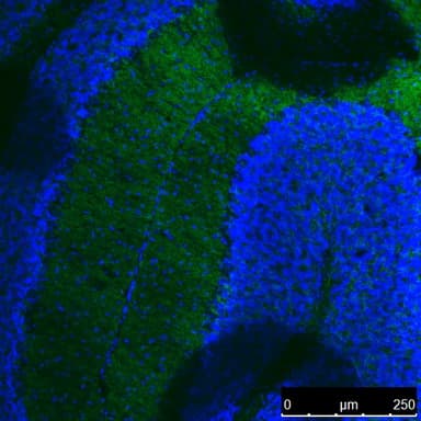 Monoclonal Mouse mOrange Antibody (IHC, WB)