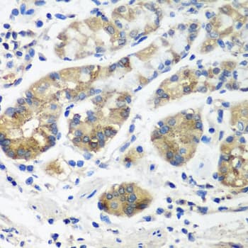 STX16 / Syntaxin 16 Antibody