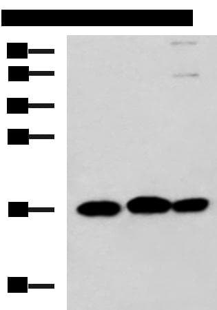 Polyclonal Rabbit anti-Human RPS14 / Ribosomal Protein S14 Antibody (IHC, WB)