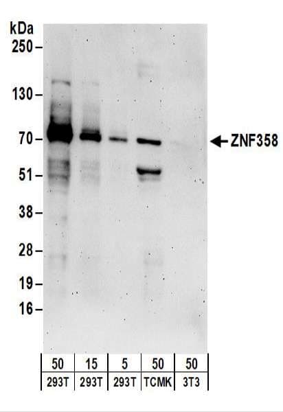 Polyclonal Rabbit anti-Human ZNF358 / ZFEND1 Antibody (aa518-568, WB)