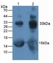 HbA1c / Hemoglobin a1c Antibody