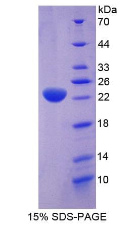 Human STI1 / STIP1 Protein (Recombinant His-GST)
