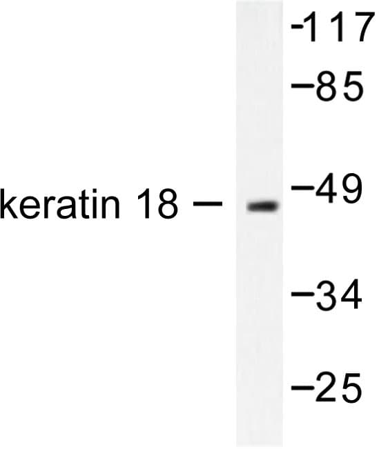 Polyclonal Rabbit anti-Human KRT18 / CK18 / Cytokeratin 18 Antibody (Thr410, IHC, IF, WB)