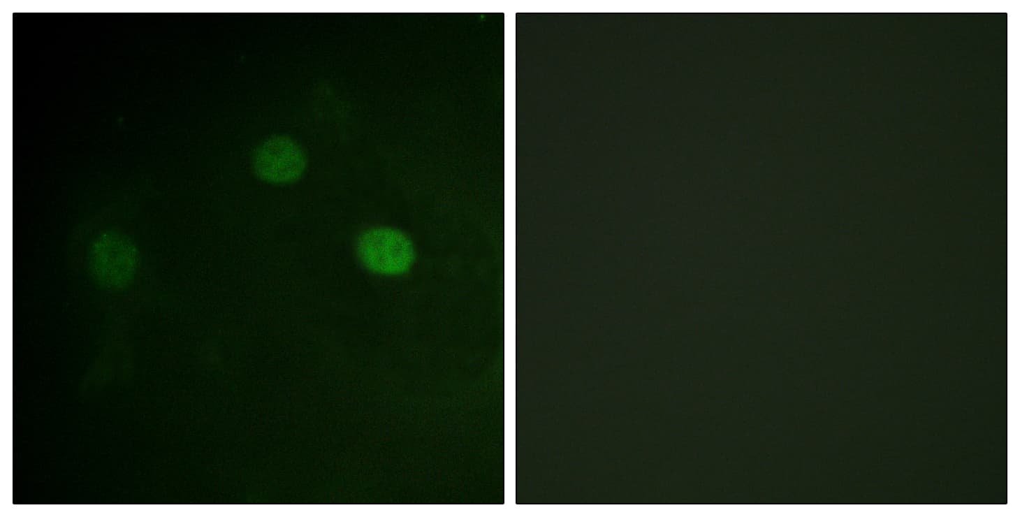 CDK1 / CDC2 Antibody (phospho-Thr14)