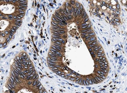 HDAC5 Antibody