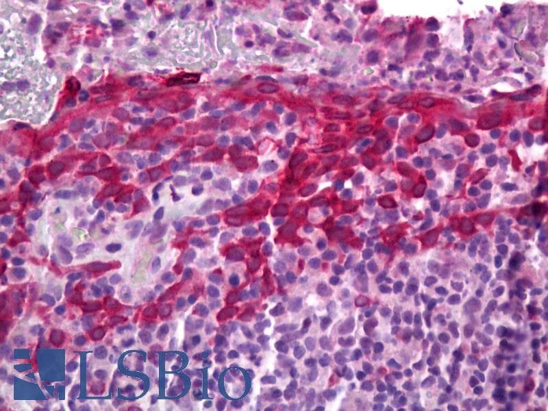 IHC-plus™ Polyclonal Rabbit anti-Human PGES / PTGES Antibody (IHC, WB)