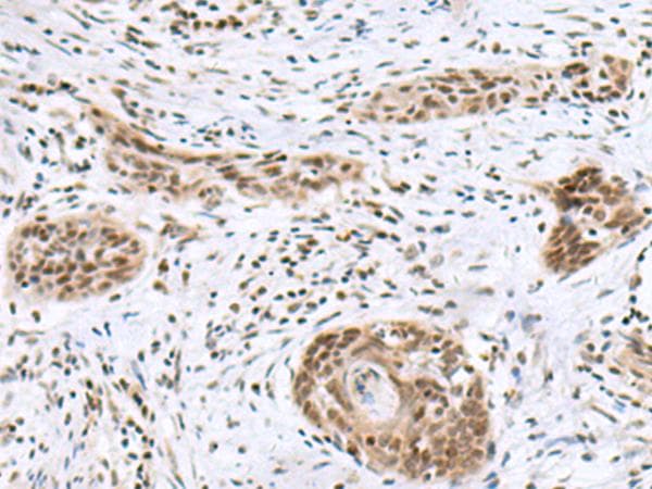 INSM1 Antibody