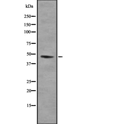 SUV39H1 Antibody
