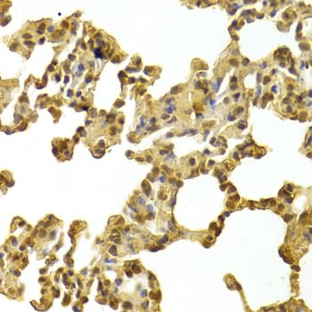 Polyclonal Rabbit anti-Human CDK4 Antibody (IHC, IF, WB)