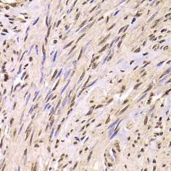 Polyclonal Rabbit anti-Human SNRPA / U1A Antibody (IHC, IF, WB)