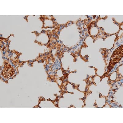 EZR / Ezrin Antibody (phospho-Tyr478)