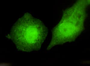 TBL1XR1 / TBLR1 Antibody