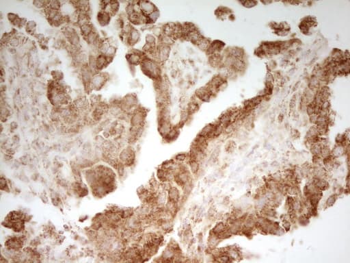 Monoclonal Mouse anti-Human MRRF Antibody (clone OTI1D5, aa56-262, IHC, WB)