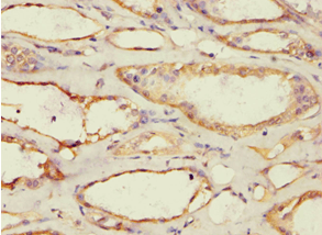 Polyclonal Rabbit anti-Human ACAT1 Antibody (aa1-145, IHC, WB)