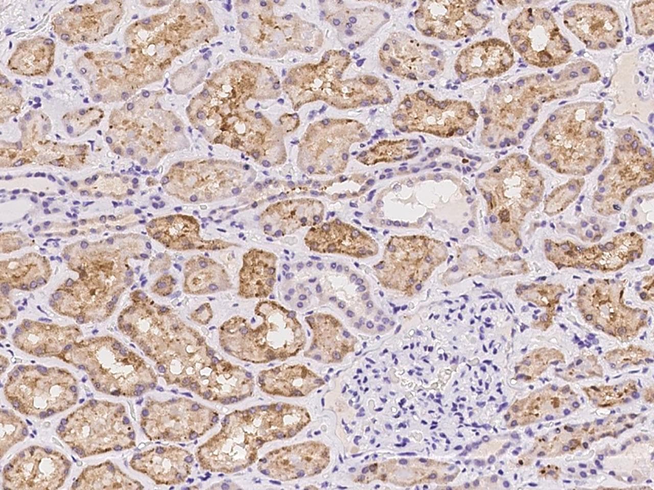 Polyclonal Rabbit anti-Human NCAN / Neurocan Antibody (IHC)