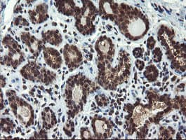 PPAT Antibody (aa42-278, clone OTI1B11)