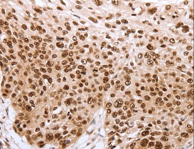 PARP1 Antibody