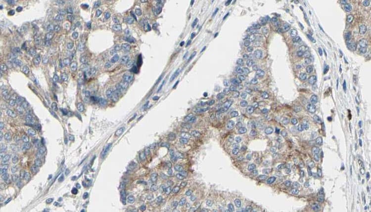 Polyclonal Rabbit anti-Human TPM3 Antibody (IHC, IF, WB)