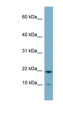 DESI1 / PPPDE2 Antibody (C-Terminus)