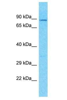 SENP7 Antibody (aa208-257)