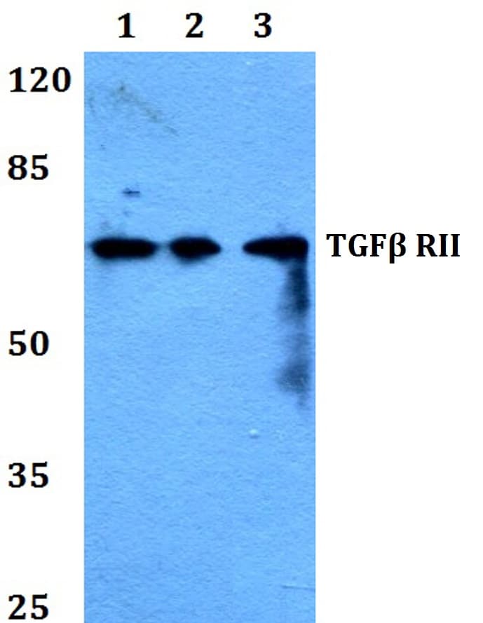 IHC-plus™ TGFBR2 Antibody (aa100-150)