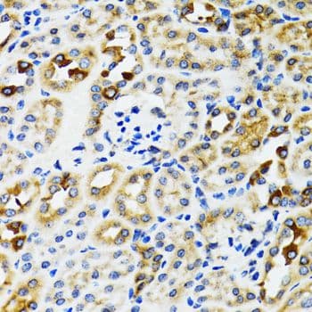 RPN1 / Ribophorin I Antibody