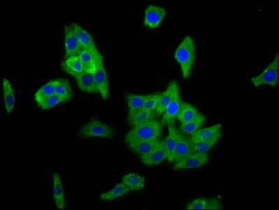 Polyclonal Rabbit anti-Human PCDH11X / Protocadherin 11 Antibody (aa987-1117, IHC, IF)