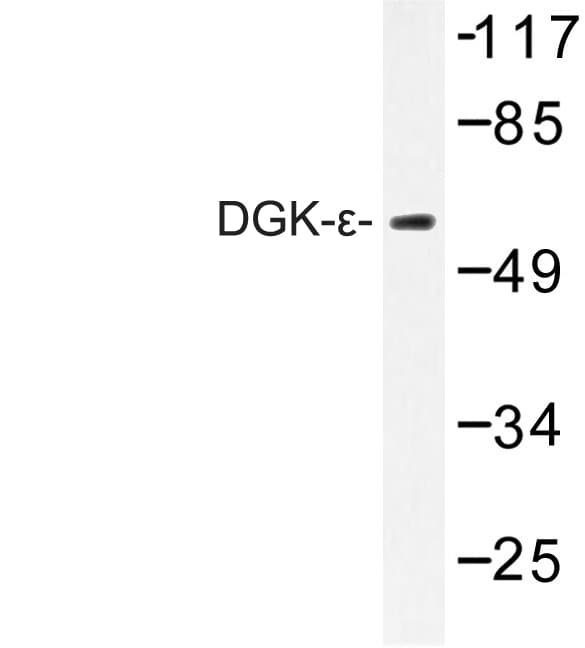 DGKE / DGK Epsilon Antibody (Ser194)