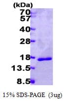 Human LGALS14 / CLC2 Protein (Recombinant His)