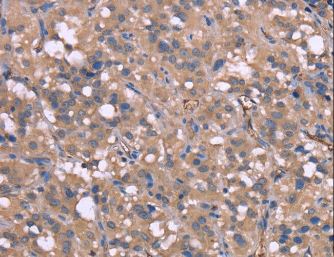 HP / Haptoglobin Antibody