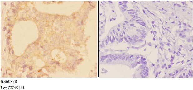 ADAM28 Antibody